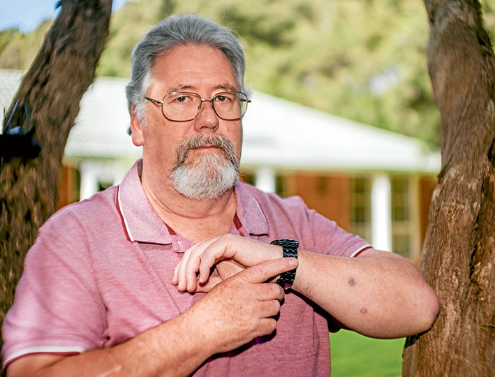 Sore spots: Pete Connell fears for peninsula with the increase of flesh-eating ulcers. Picture: Yanni